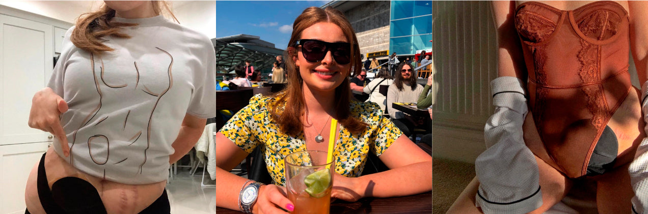 Ostomy Features - Sarah Speaks To... Joy